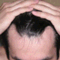 imstars_hair