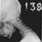 trzr138